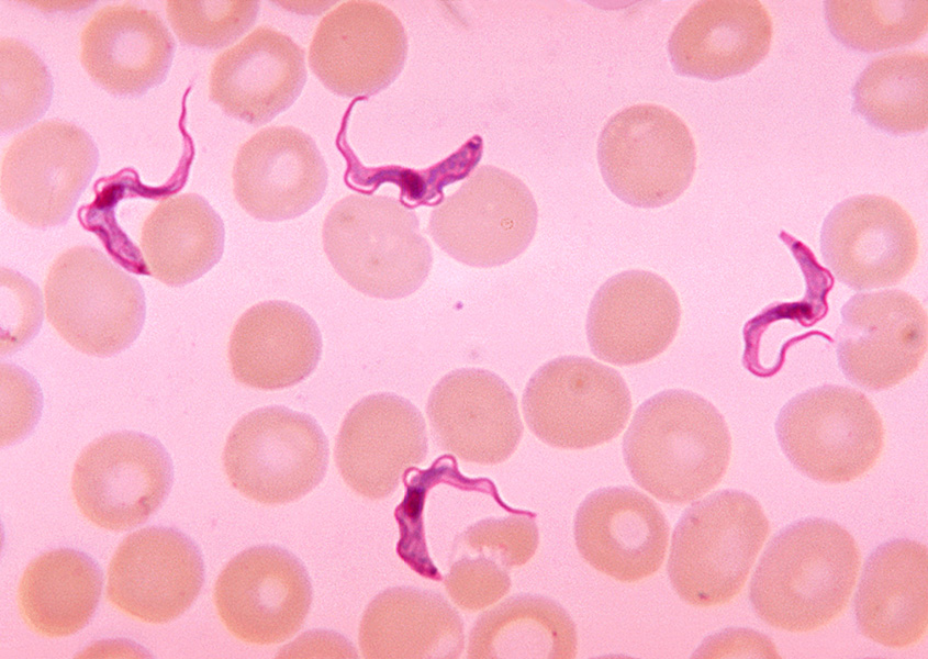 A light microscope image shows ribbony trypanosome parasites and disc-shaped human blood cells against a pink background.